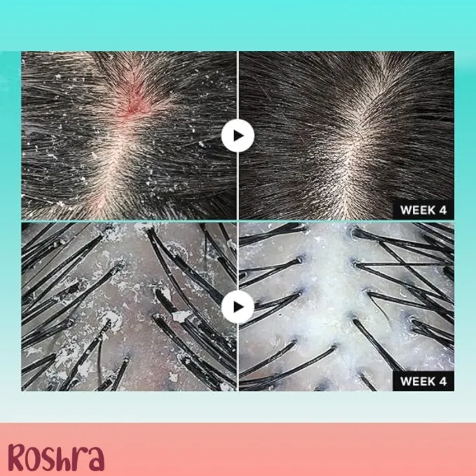 سرم اسکالپ PDRN لیلیوئه image