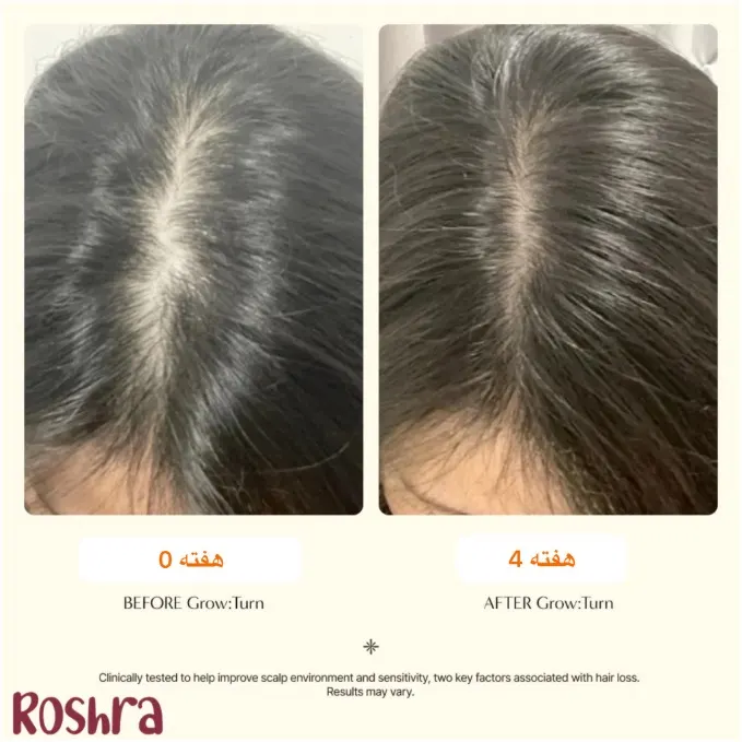سرم اسکالپ محرک رشد مو لیلیوئه image