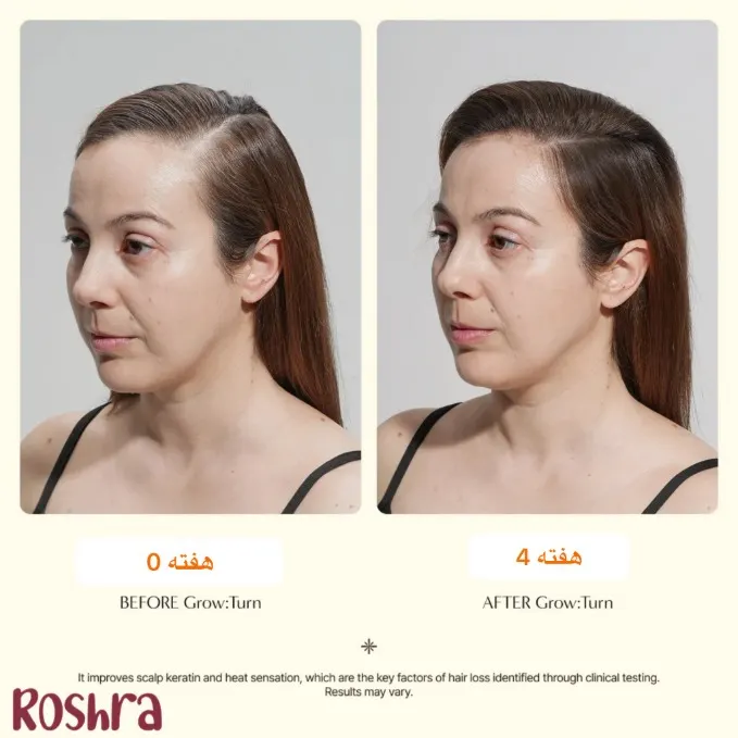 سرم اسکالپ محرک رشد مو لیلیوئه image