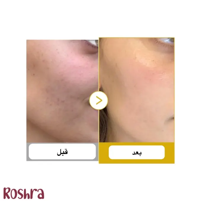 سرم میست ژله ای کوجیک اسید مدی کیوب image
