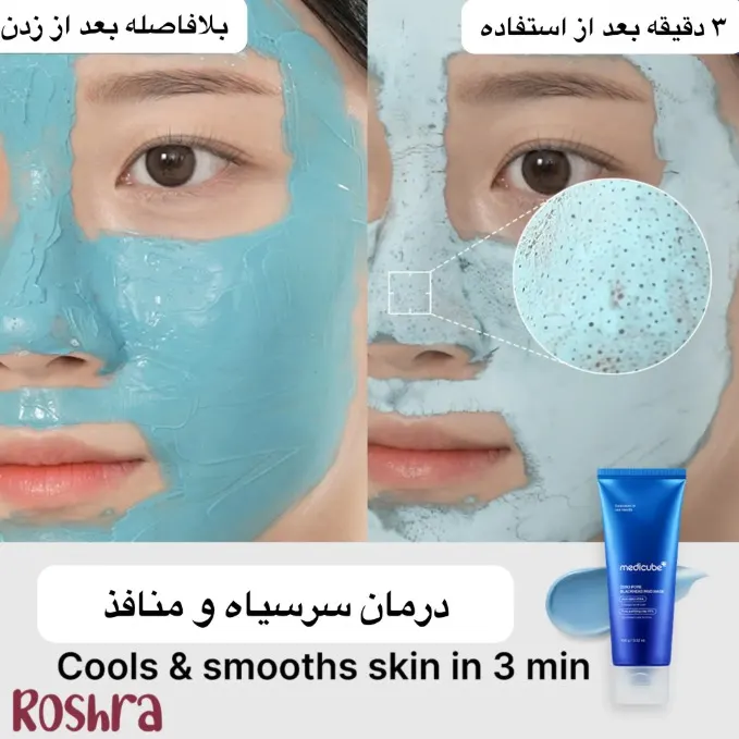 ماسک کنترل منافذ و جوش سرسیاه زیرو مدی کیوب image