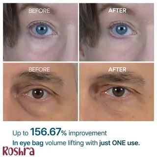 کرم دور چشم دکتر ملاکسین آی فالت image