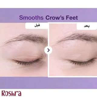 کرم دور چشم رتینال نامبوزین شماره 9 image