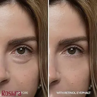 کرم دورچشم رتینول دکتر ملاکسین image