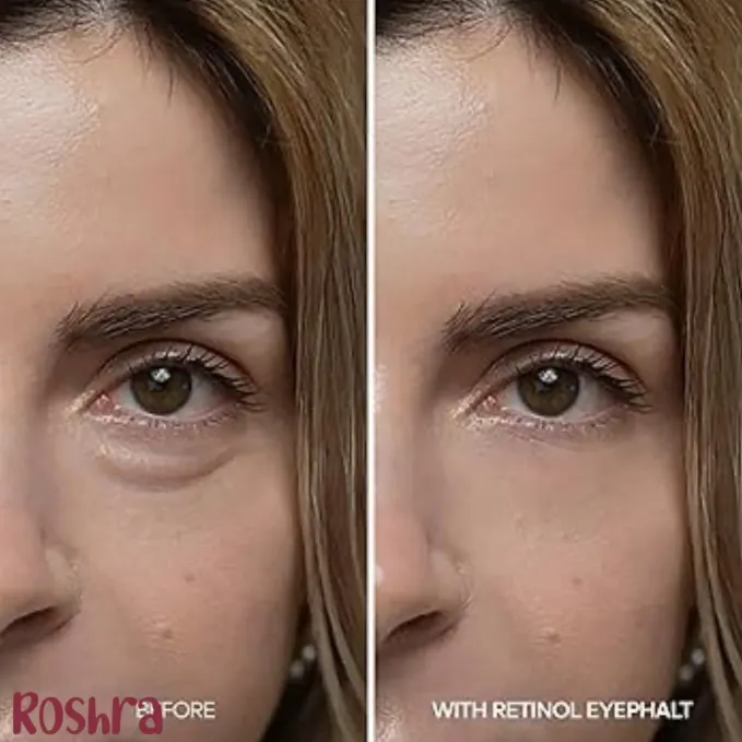 کرم دورچشم رتینول دکتر ملاکسین image