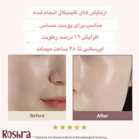 شوینده رزهیپ آرنسیا image
