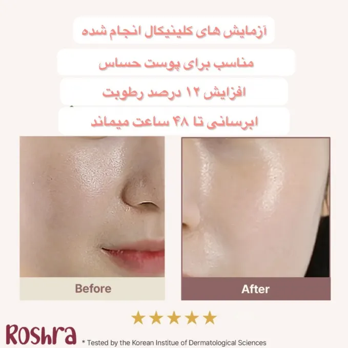 شوینده رزهیپ آرنسیا image