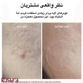شوینده موچی چای سیاه و یوجا آرنسیا image