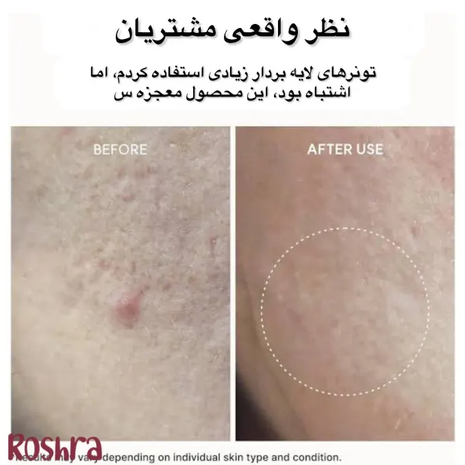 شوینده موچی چای سیاه و یوجا آرنسیا image