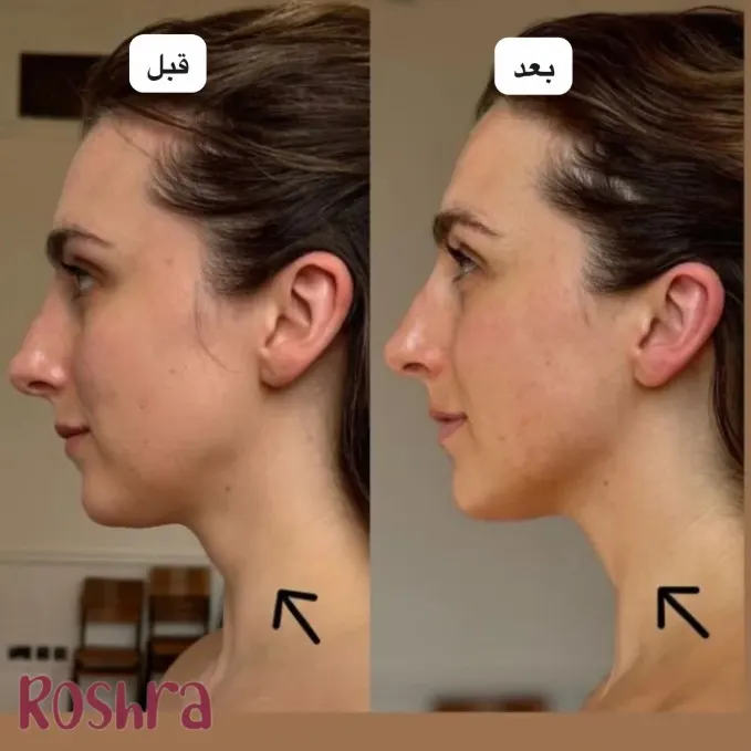 کرم گواشا مدیکیوب image