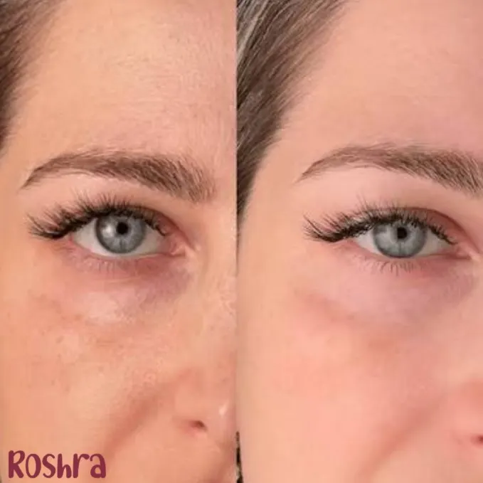 کرم دور چشم PDRN و کافئین آنوا image